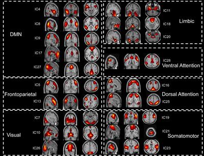 Ability of an altered functional coupling between resting-state networks to predict behavioral outcomes in subcortical ischemic stroke: A longitudinal study